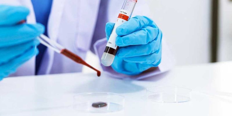 You are currently viewing Japan Has Made Artificial Blood — Why It’s a Bigger Deal Than You Think