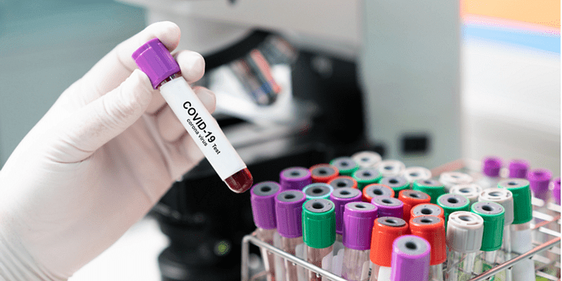 You are currently viewing New double mutant variant of the COVID-19 virus has been found in India: Health Ministry