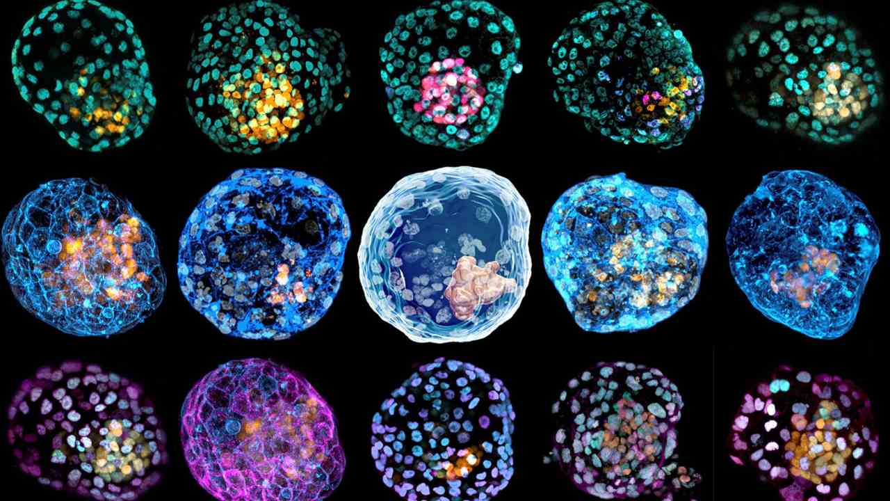 You are currently viewing Pre-embryos made in a lab to study birth defects could spur research, ethical debate- Technology News, FP