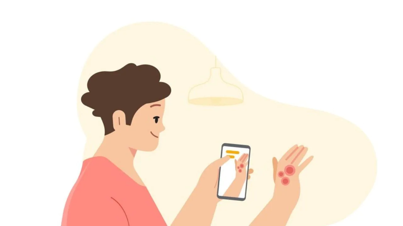 Read more about the article Dermatology assist tool showcased, to help get info about common skin condition using smartphone camera- Technology News, FP