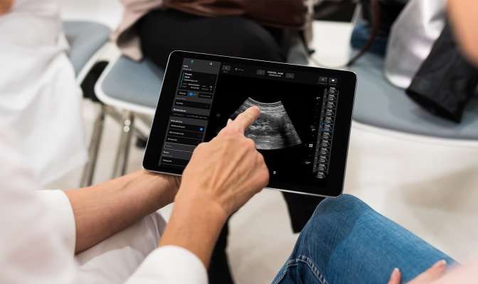 You are currently viewing Exo secures $200M toward commercializing ultrasound device – TechCrunch