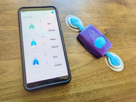 You are currently viewing Lung-health startup Respira Labs inhales $2.8M to help respiration patients breathe easier – TechCrunch